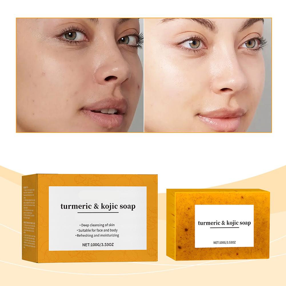 100g Zerdeçal El Yapımı Sabun, - Kojic Acid Soap incelemesi ve fiyatı