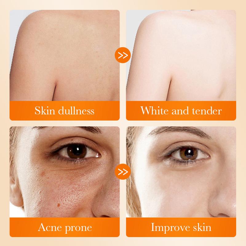 1 adet SADOER Kojik Asit Yüz S - Kojic Acid Soap incelemesi ve fiyatı