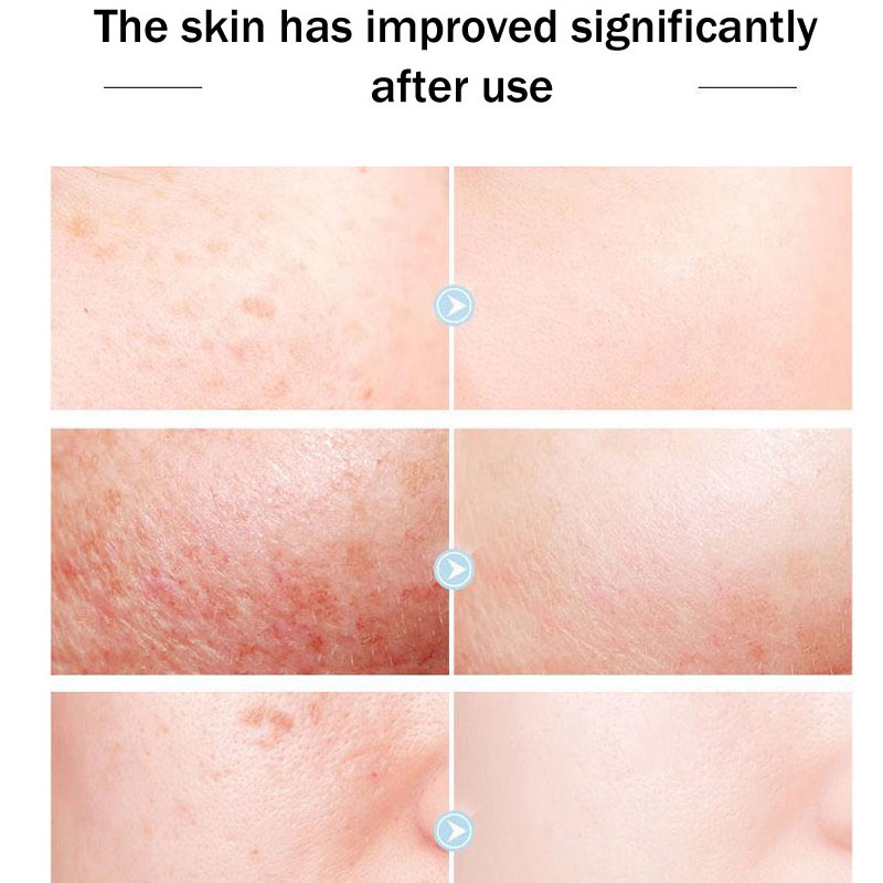 Orijinal kraliçe marka yüz kre - Skincare Queen incelemesi ve fiyatı
